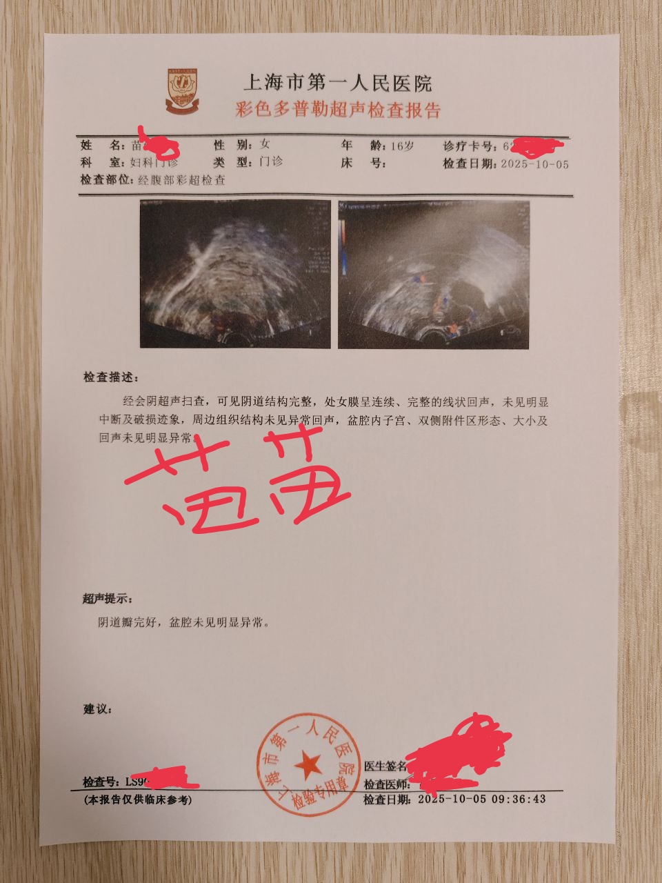 浦东07后新人满族苗苗刚破处 Gallery 3