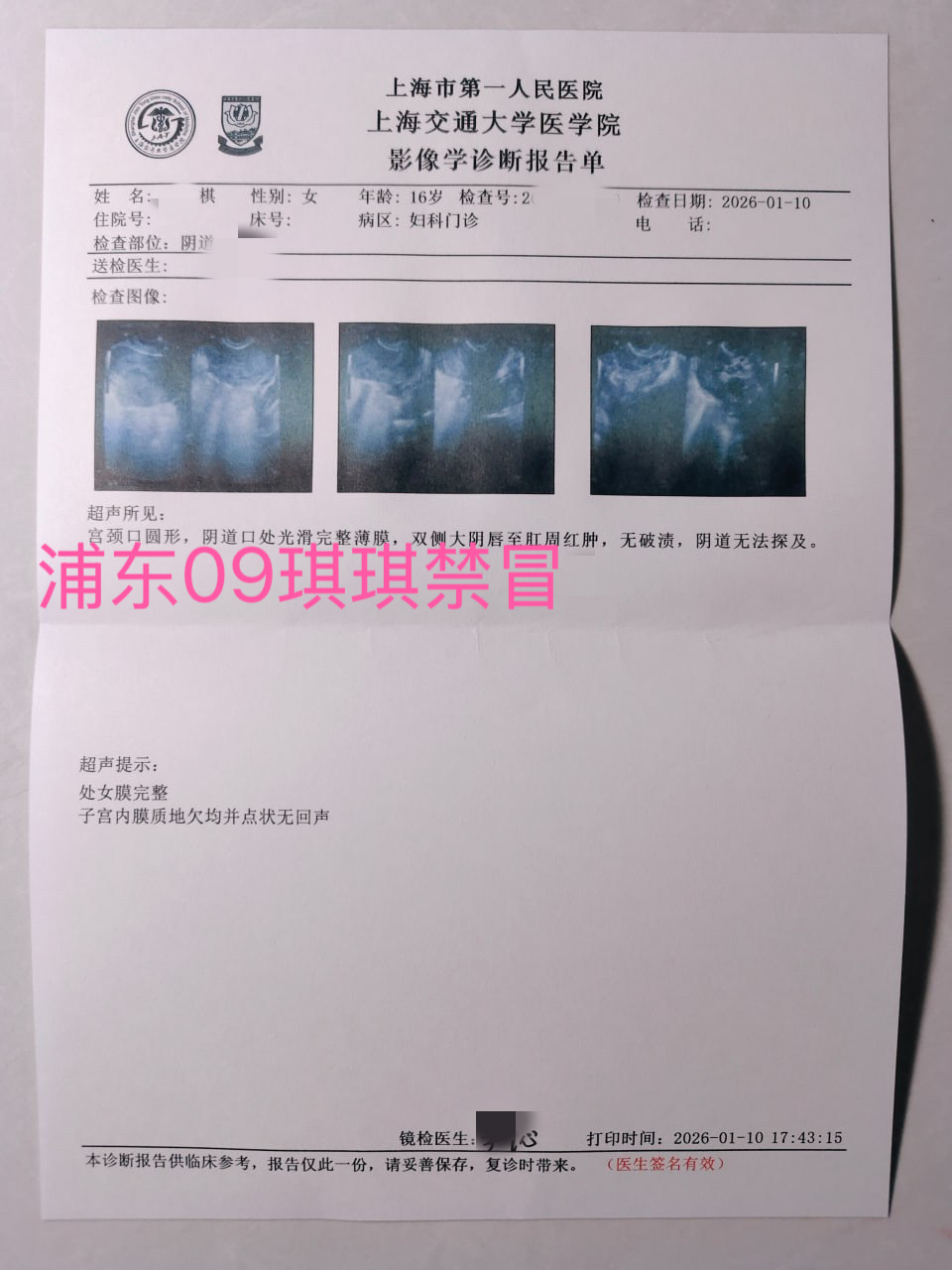 1.12新人浦东09后新人琪琪1.10破处 Gallery 5