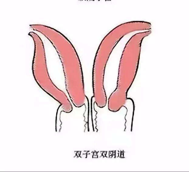 双阴道子宫:18岁学生刚破处小萝莉:安月 Gallery 6
