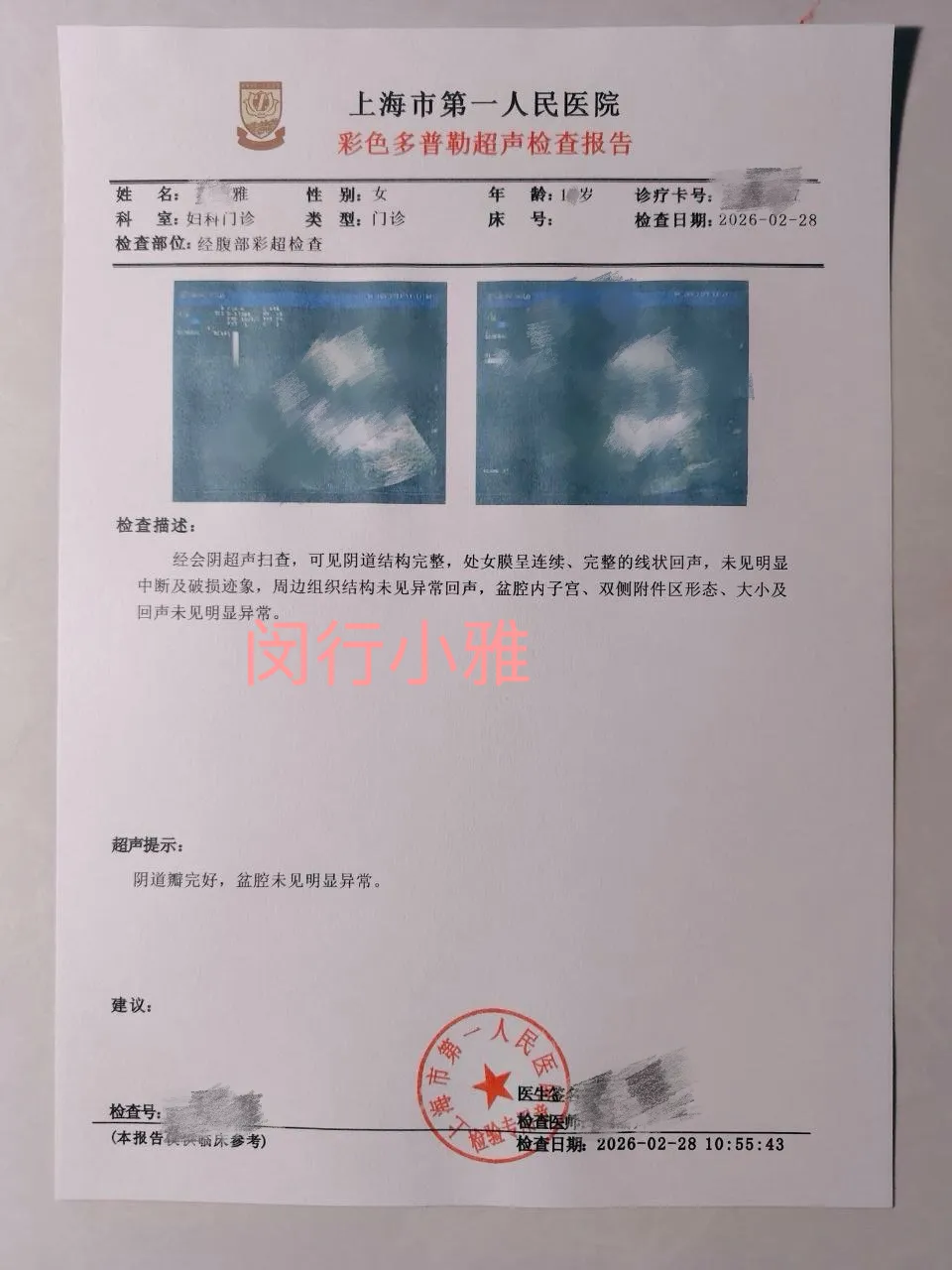 闵行4月24日巨乳萝莉08后小雅刚破处 Gallery 6