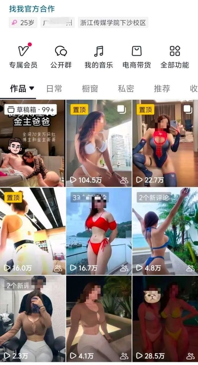 h396🦜100w网红博主 顶级身材 Gallery 1