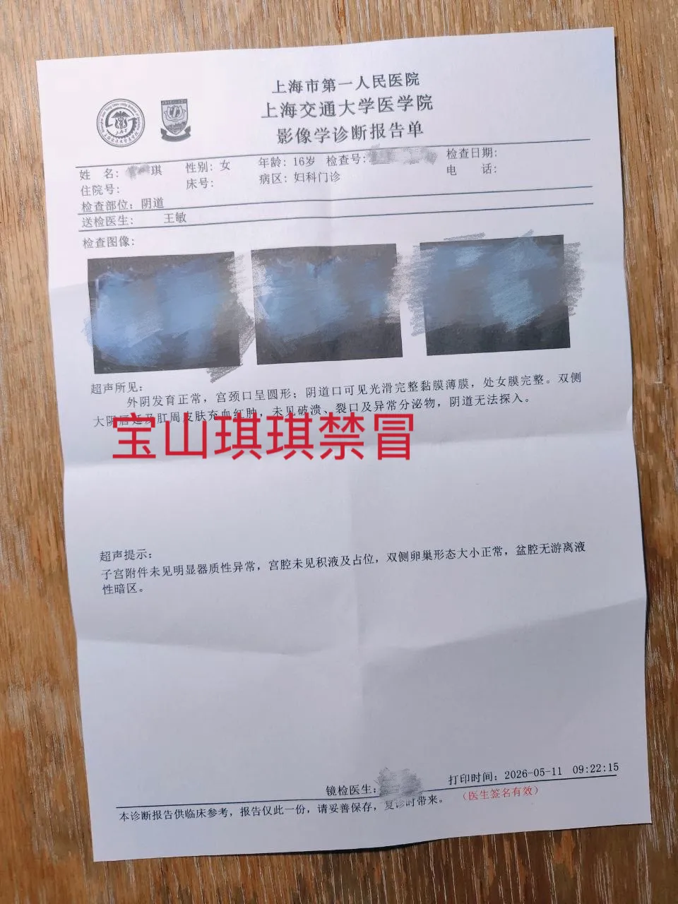 5.13宝山区08后新人琪琪刚破处 Gallery 5