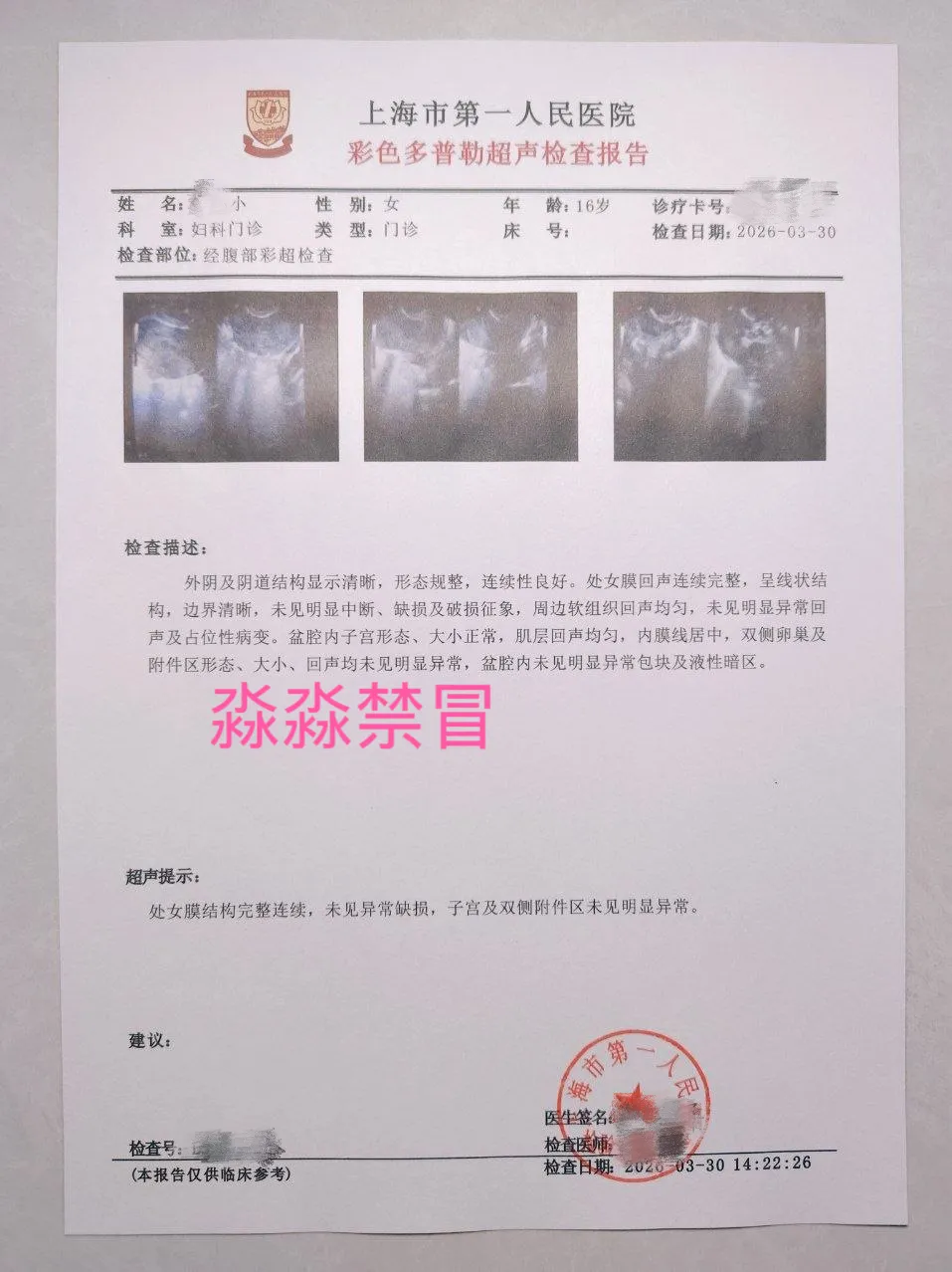 4月2日破处闵行新人08后淼淼刚破处 Gallery 5