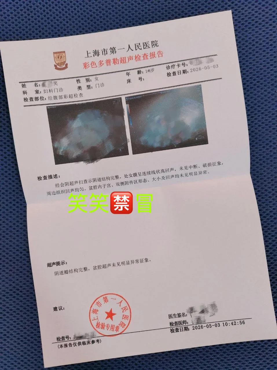 5月5日浦东新人08后笑笑可wt刚破处 Gallery 5