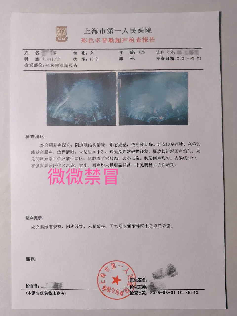 4月开松江08后新人微微可看证3月刚破处 Gallery 4