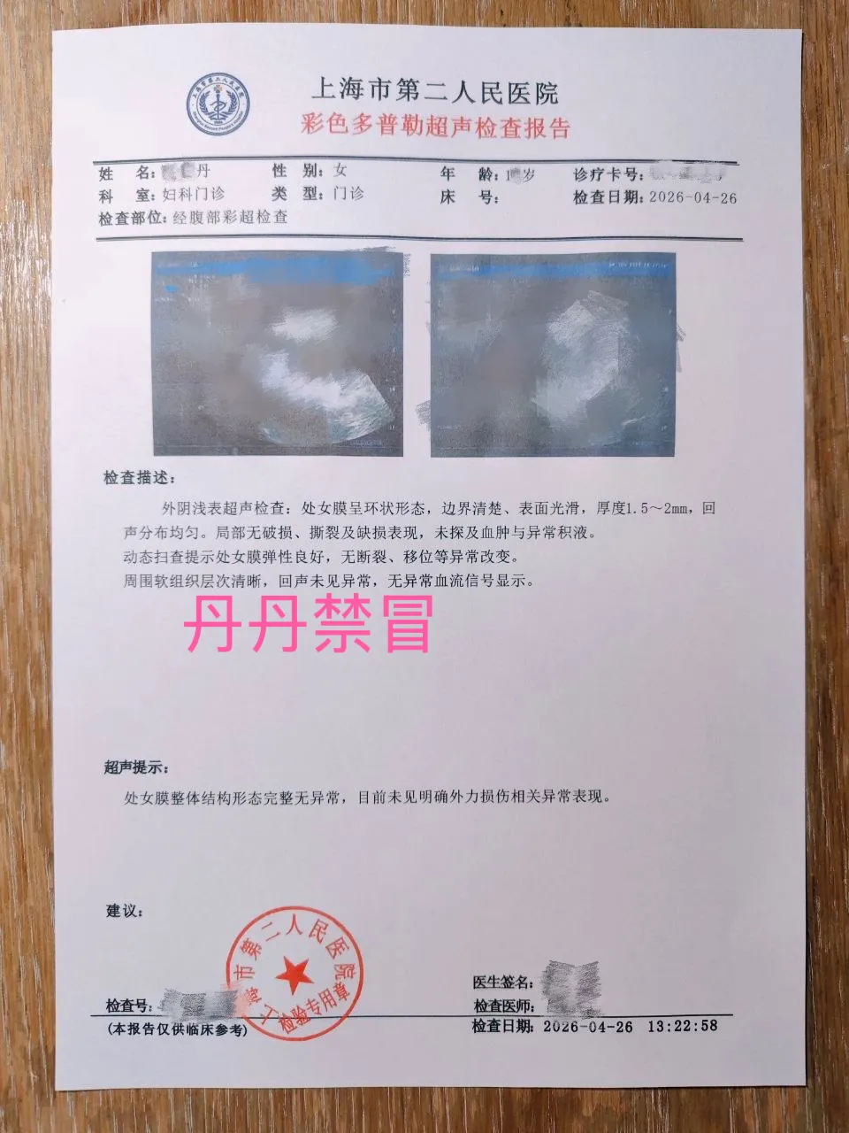 4.28闵行新人08后丹丹刚破处 Gallery 5