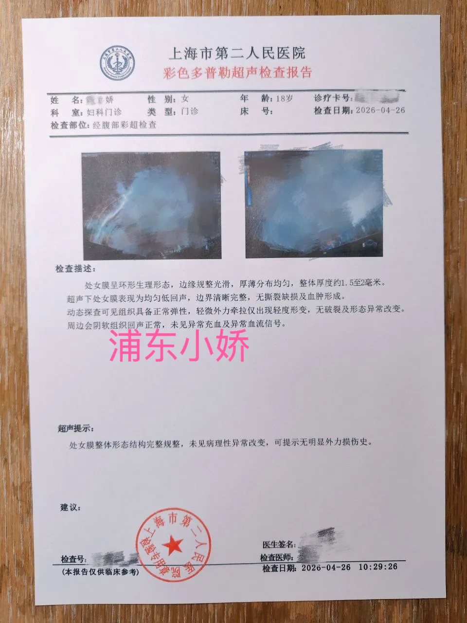 4月28日浦东08后新人小娇刚破处 Gallery 5