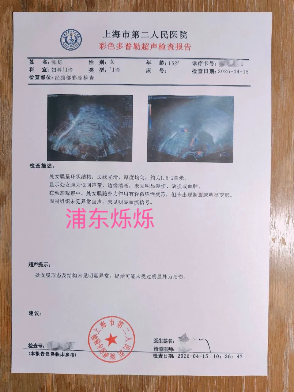 4月16日新人浦东08后烁烁刚破处 Gallery 2